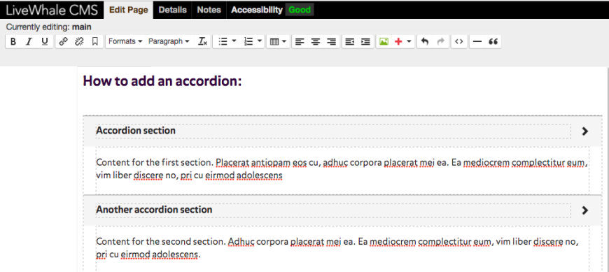Add titles and content to your accordion as shown. Once you save the page, the content of each section will be hidden.