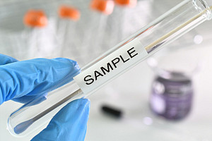 Testing swab being inserted test tube labeled sample